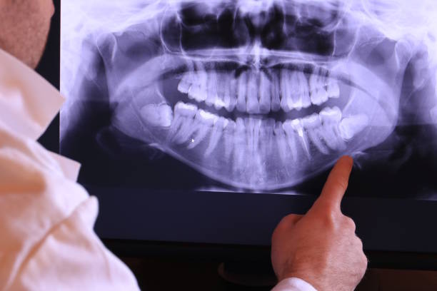 Best 24-Hour Emergency Dentist in Crofton, MD