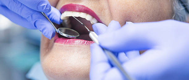 Best Emergency Root Canal Treatment in Crofton, MD